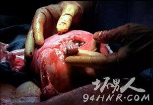 刨妇产视频,技术革新与母爱守护